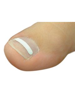 Onyclip Nagelbeugel strips  (8 stk), 0,10 mm